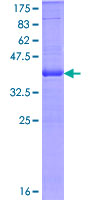 12.5% SDS-PAGE Stained with Coomassie Blue